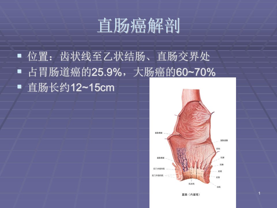 直肠癌手术术式及常见并发症ppt课件