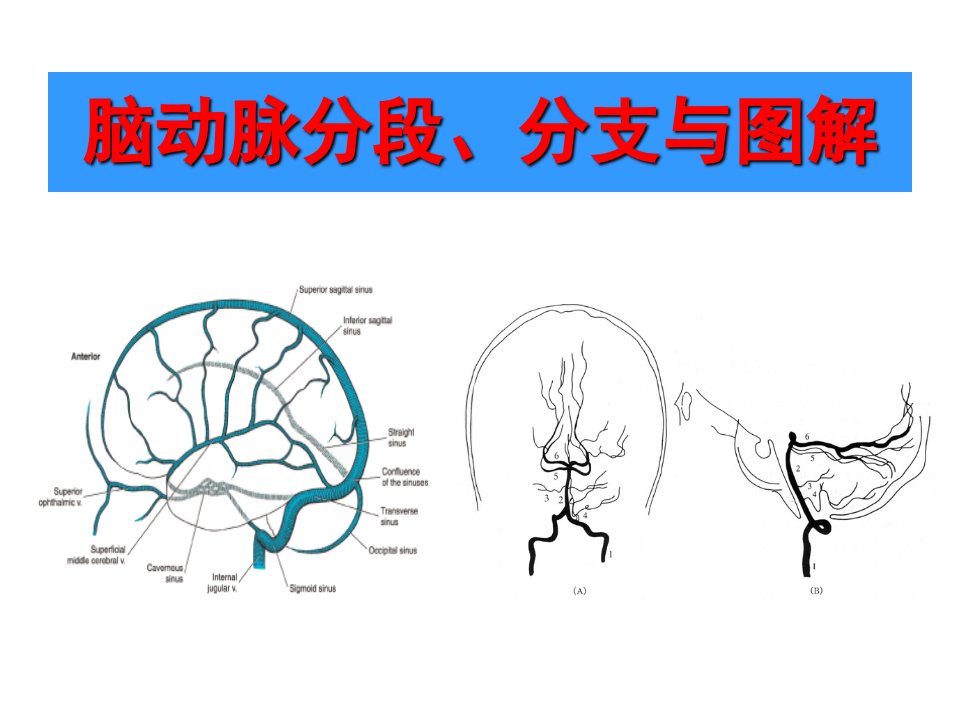 脑部血管解剖图解-影像学