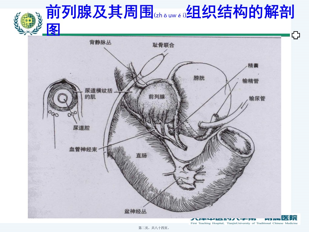 医学专题前列腺癌新研究概述