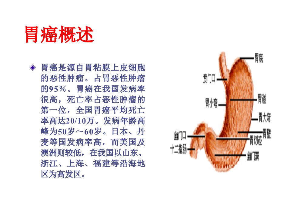 胃癌