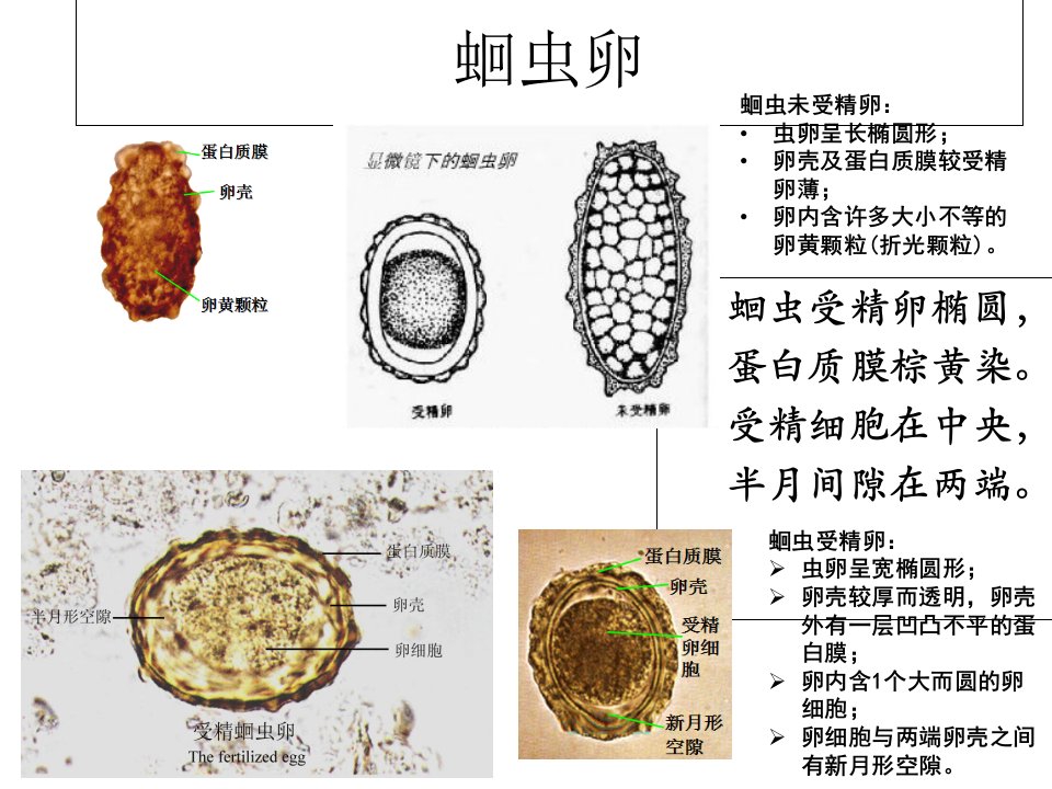 寄生虫学虫卵经典总结及图片(yj)