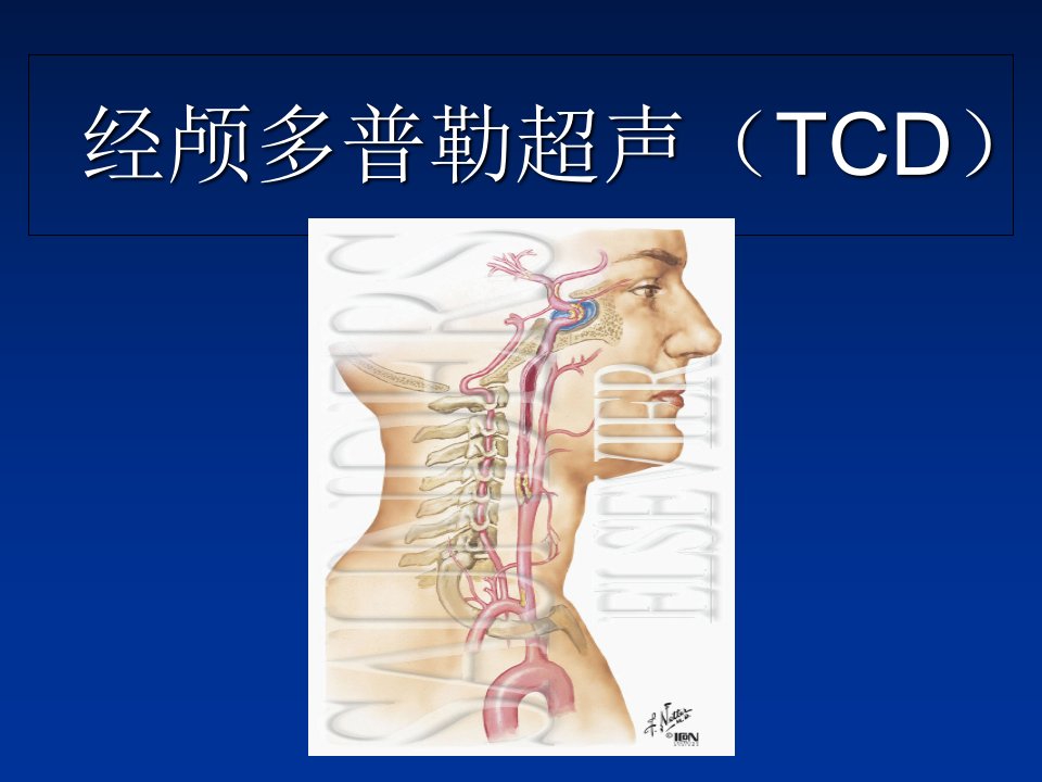 经颅多普勒超声(TCD)