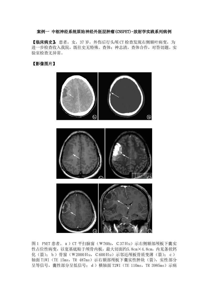 影像诊断学案例