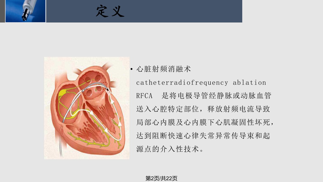 射频消融术的护理ppt课件