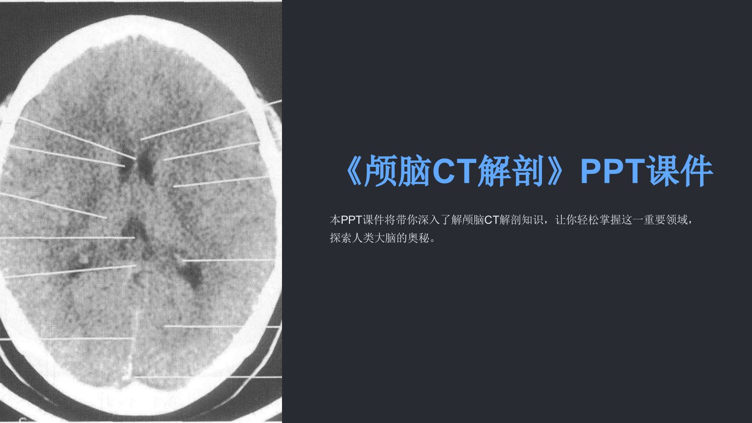 《颅脑ct解剖》课件