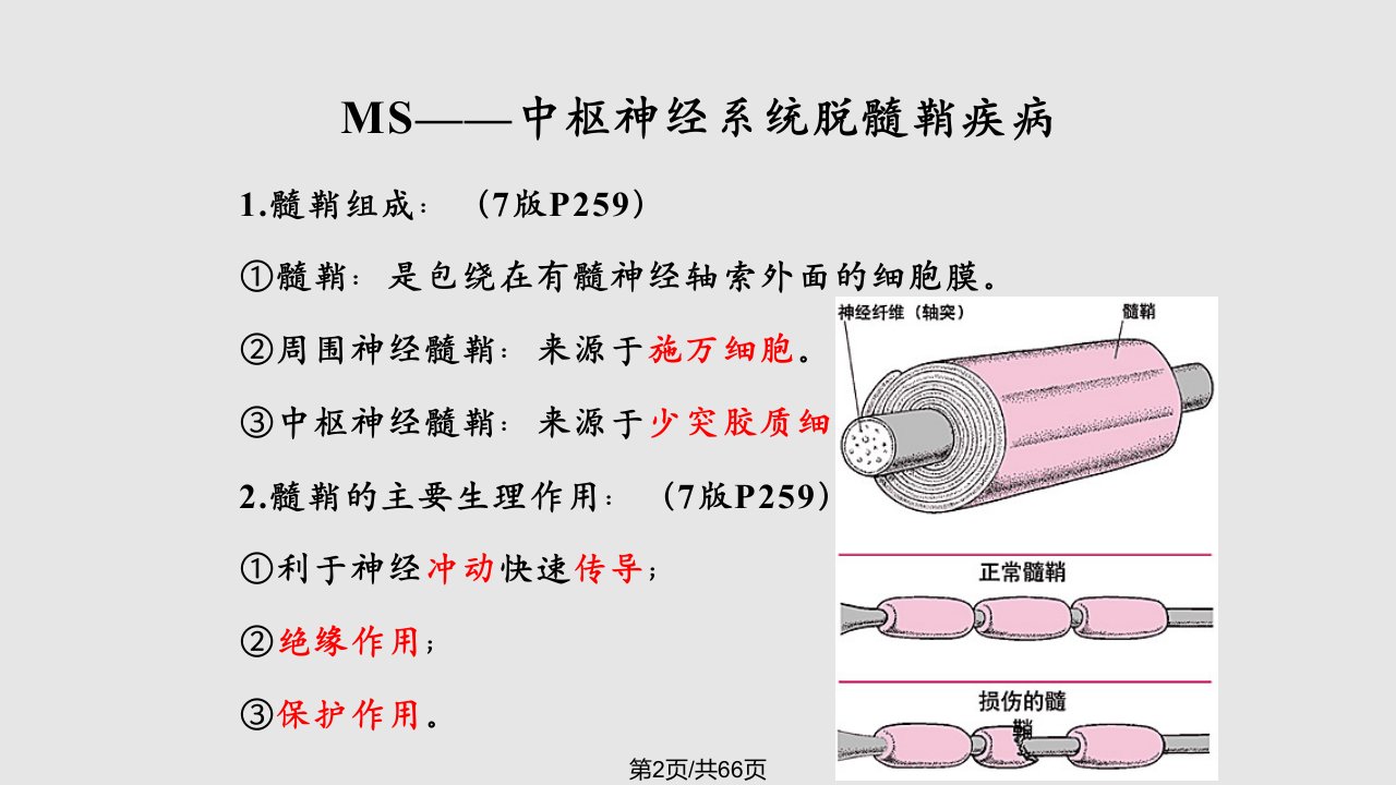 尹顺雄多发性硬化