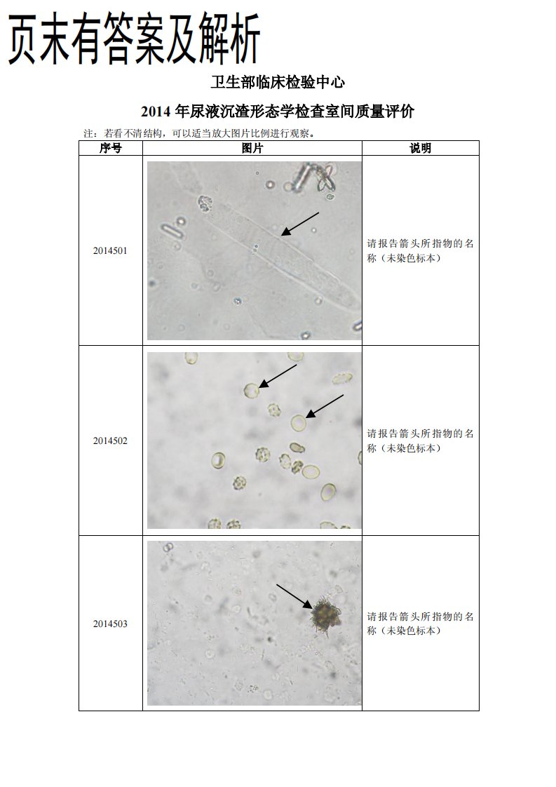 2014卫生部尿液沉渣形态学室间质评.pdf