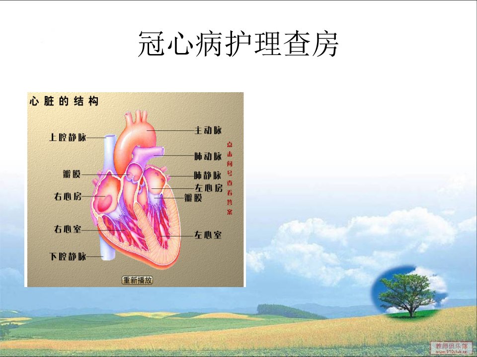 冠心病护理查房PPT课件