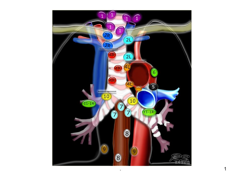 纵隔淋巴结分区ppt课件