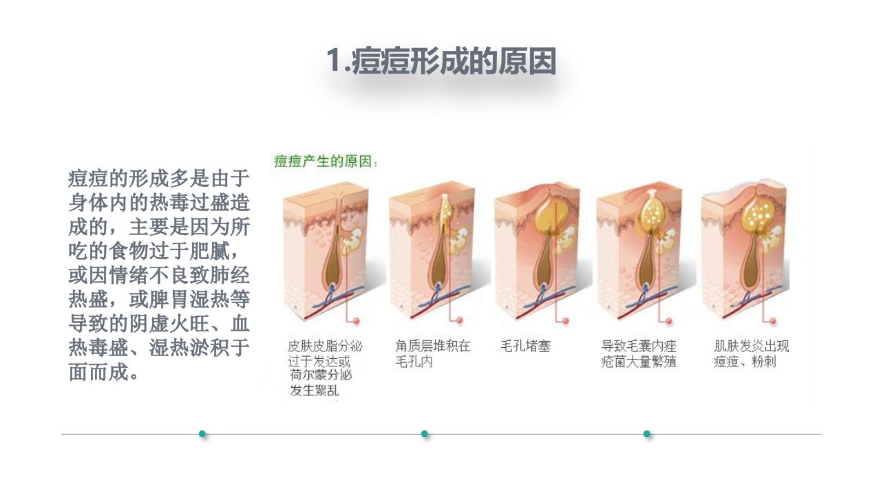 痘痘肌肤的各种类型课件