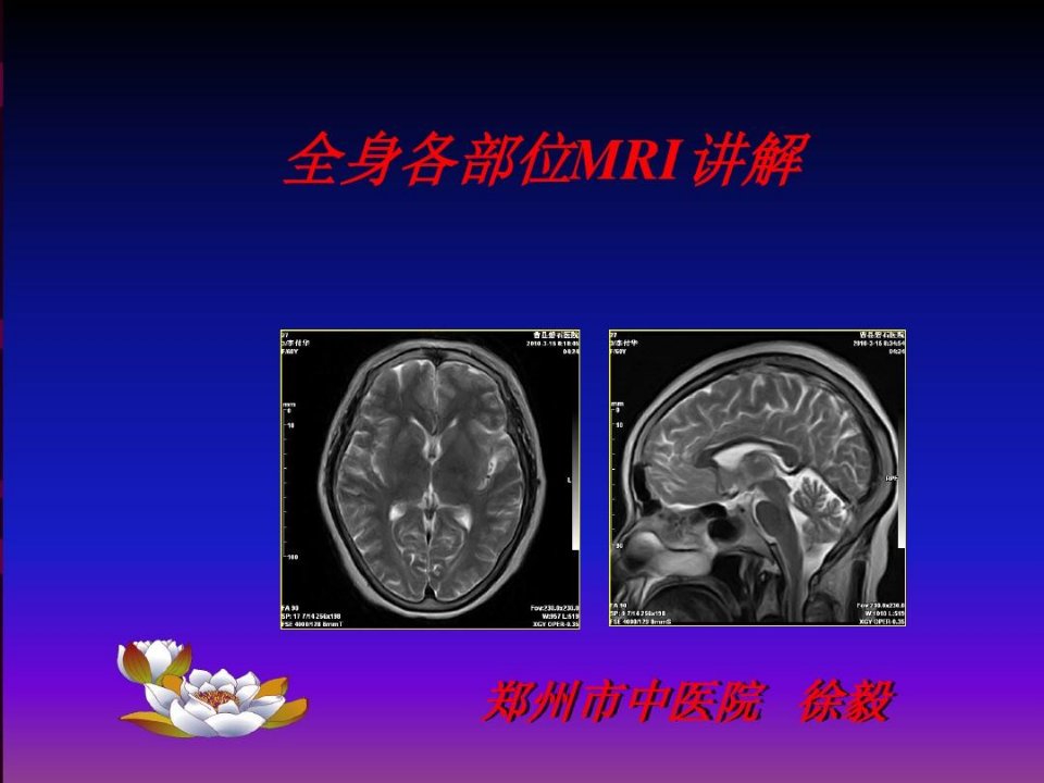 磁共振最新研究及进展