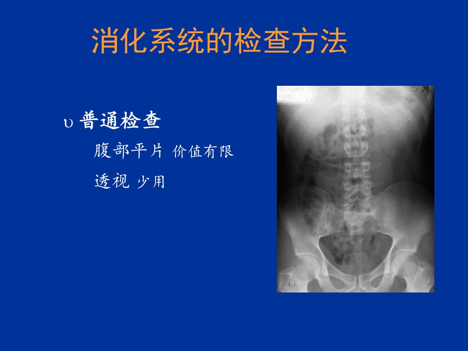 医学影像学消化系统ppt课件