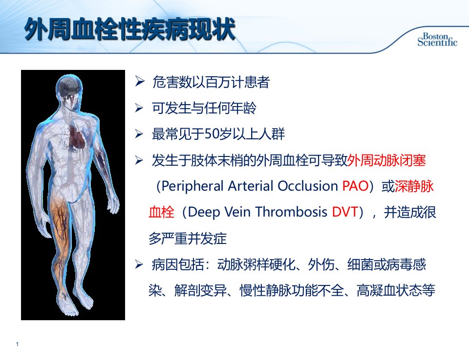 2021年AngioJet血栓抽吸系统介绍