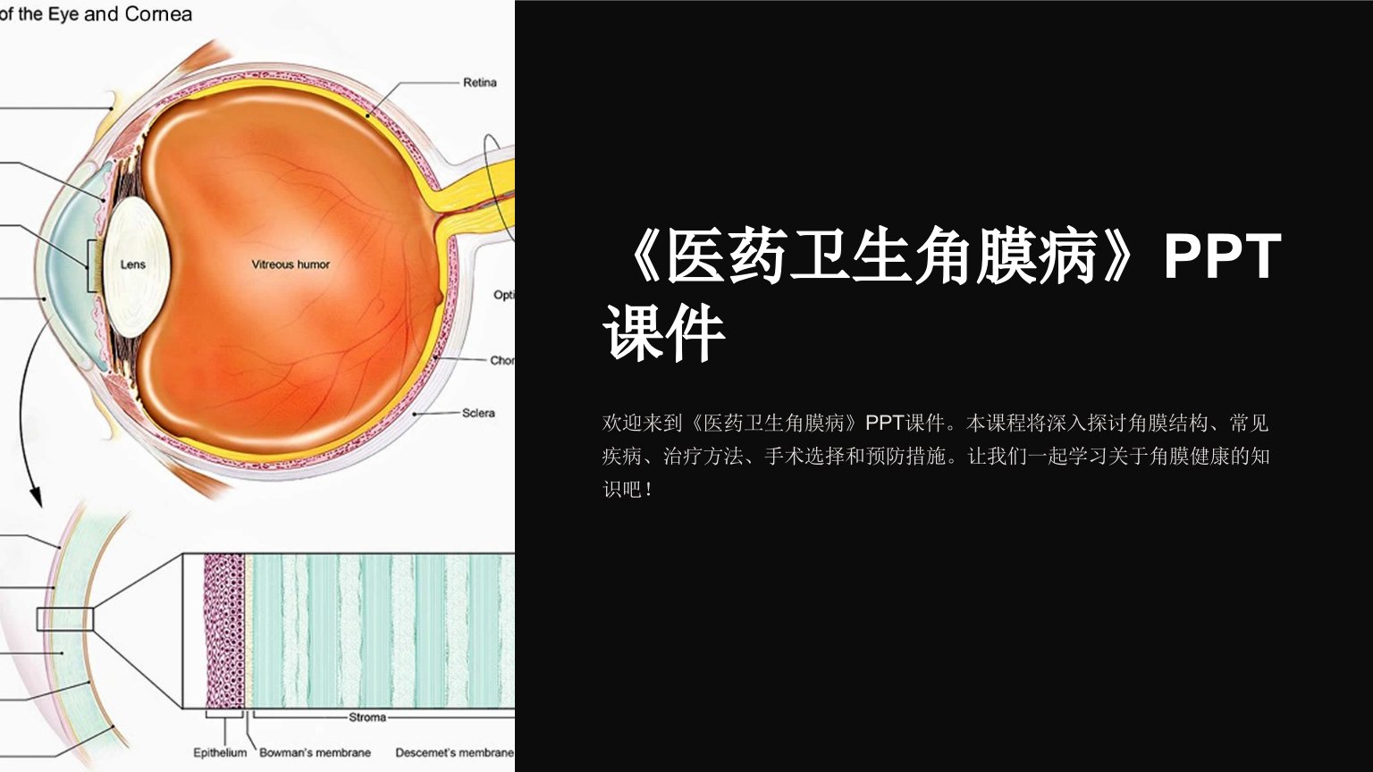 《医药卫生角膜病》课件