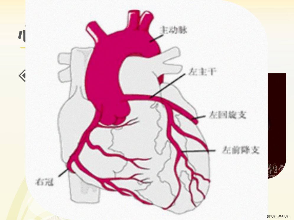 心肌梗塞护理查房PPT课件PPT45页