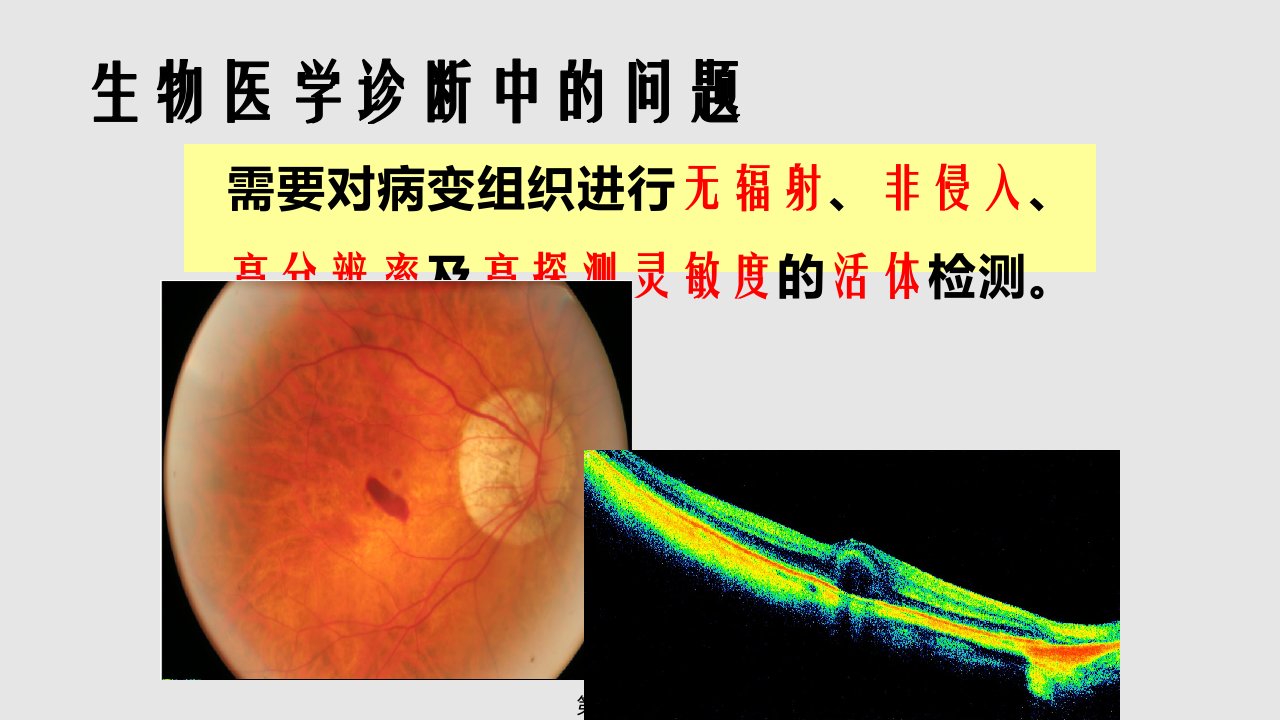 眼视光特检技术PPT课件