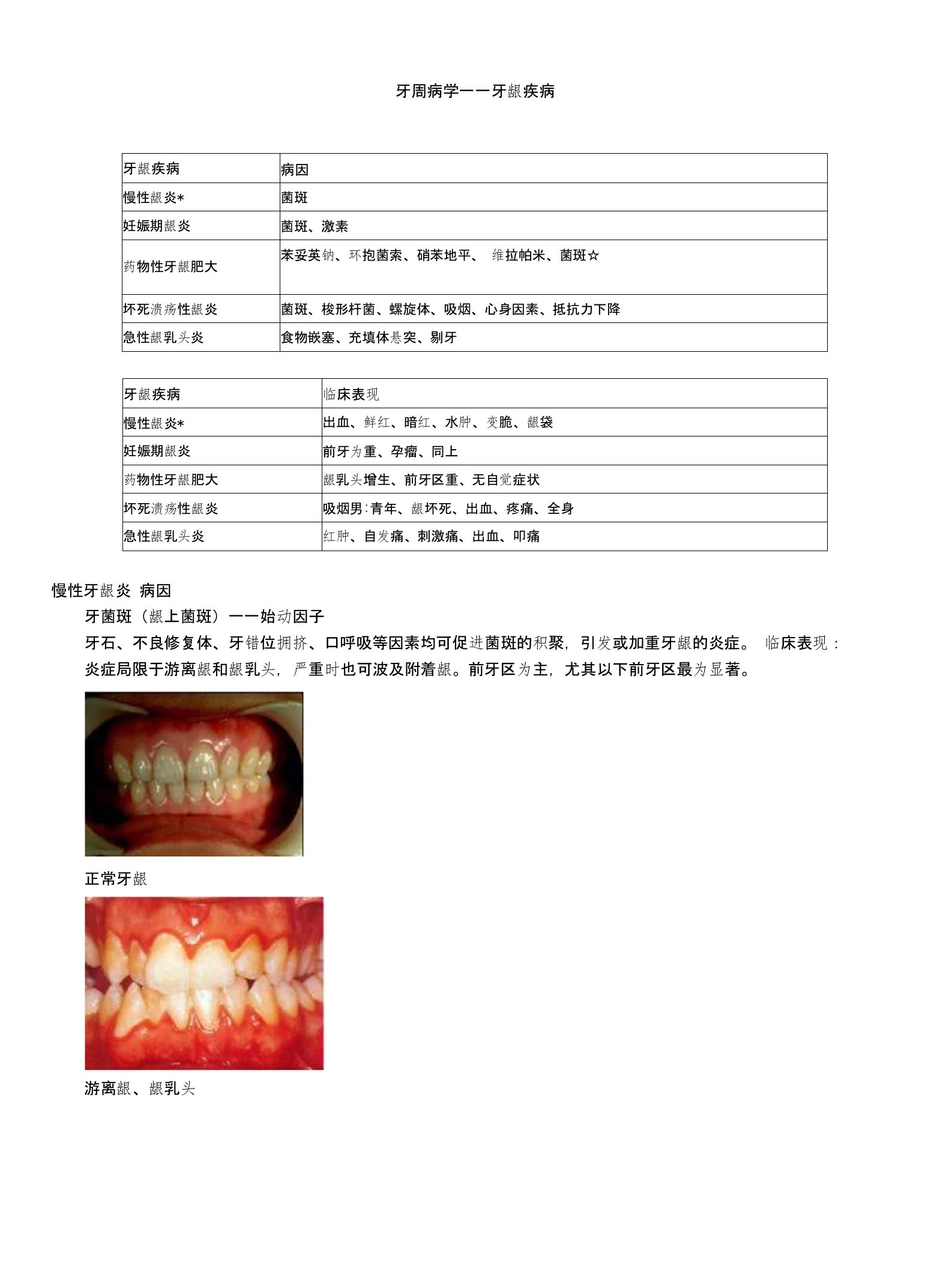 主管护师护士护理考研资格考试题库牙周病学牙龈疾病