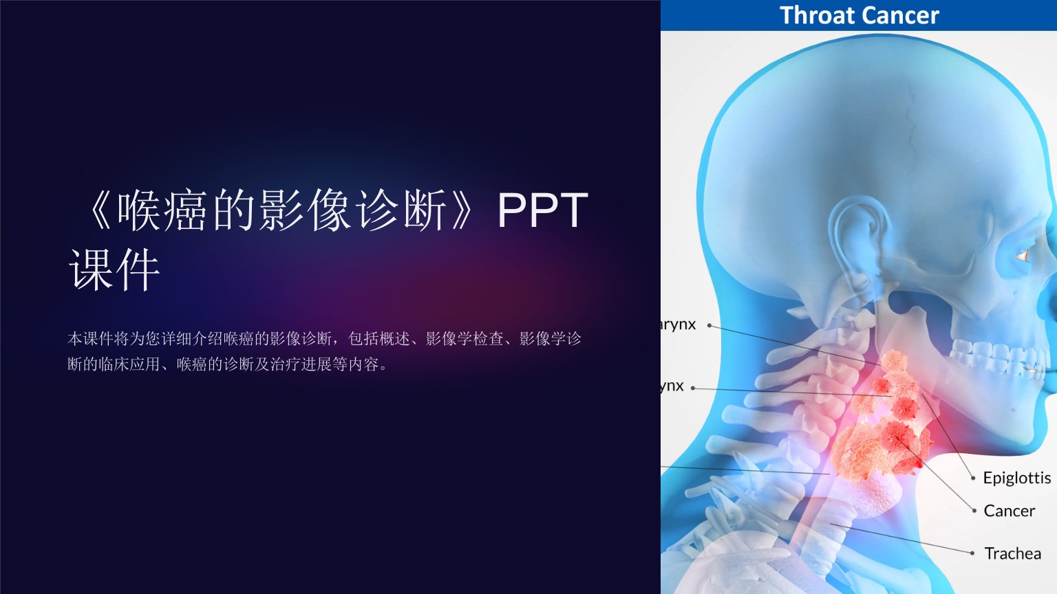 《喉癌的影像诊断》课件