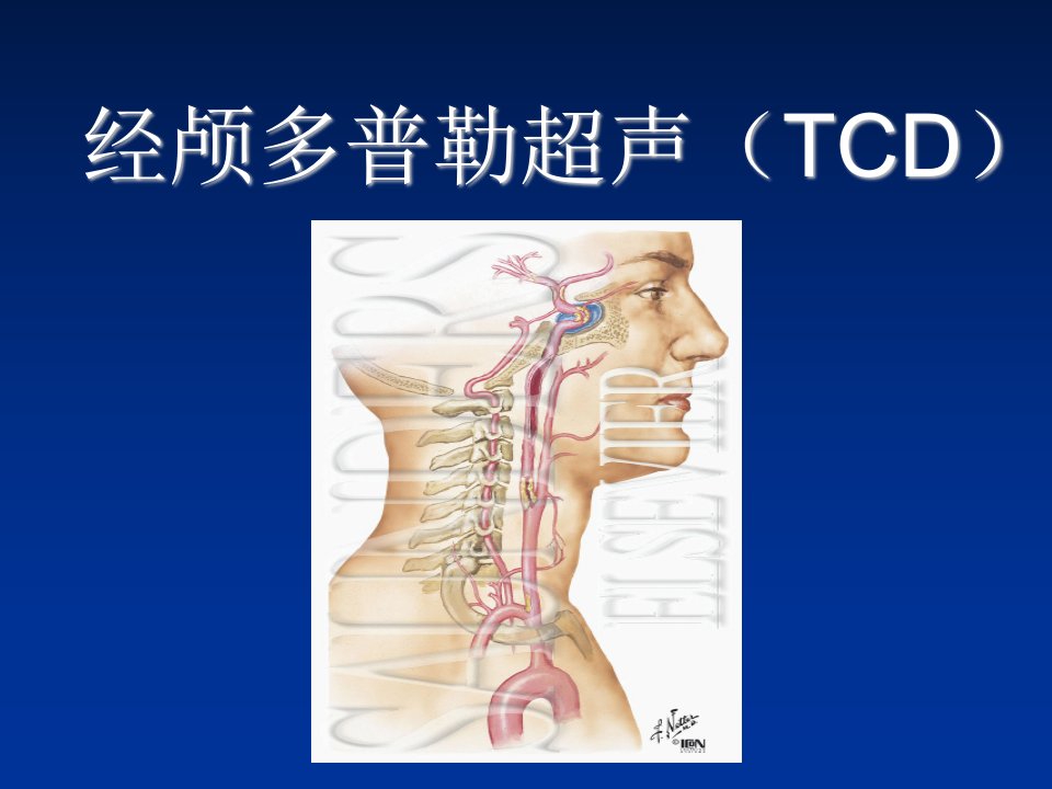 经颅多普勒超声TCD