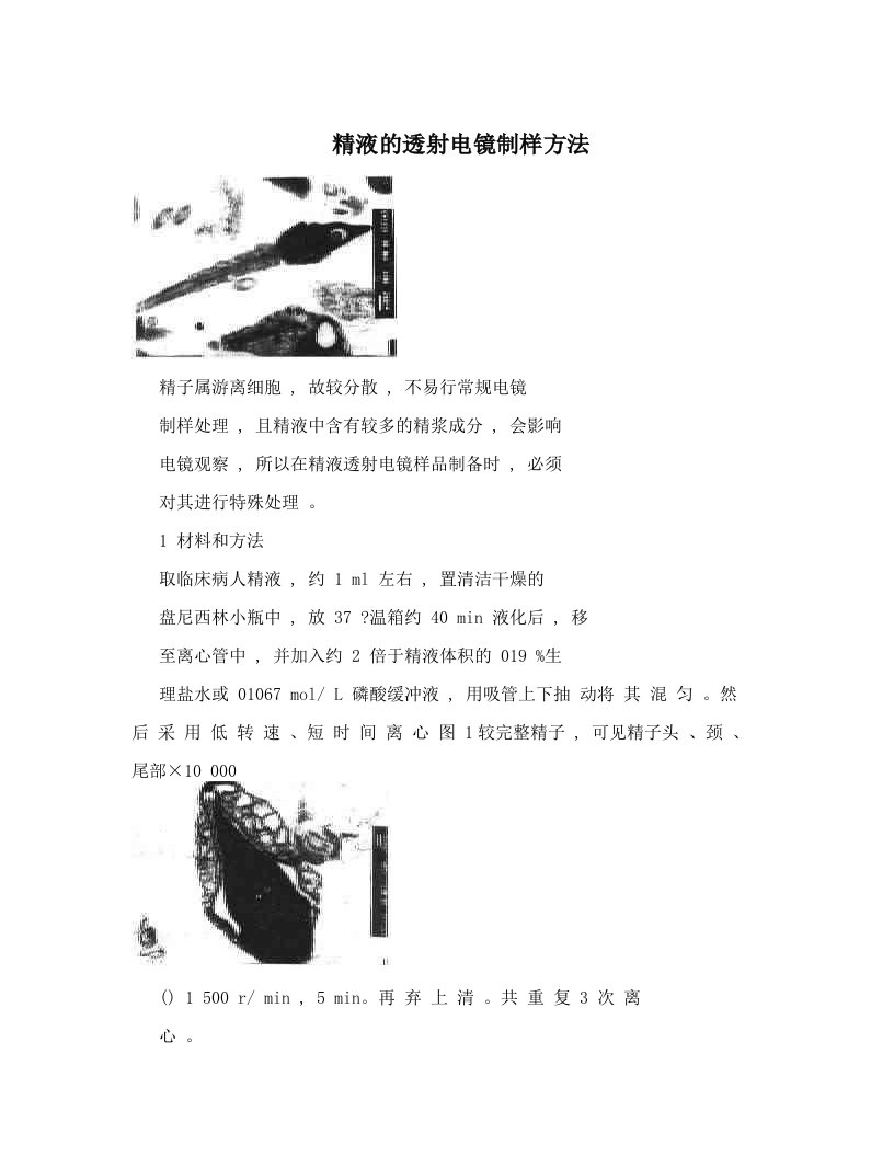 精液的透射电镜制样方法