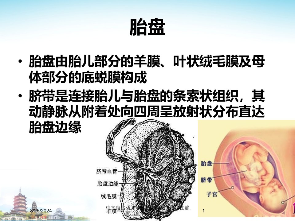 2021年中文腹主动脉球囊封堵应用在凶险性前置胎盘中的几点体会讲义