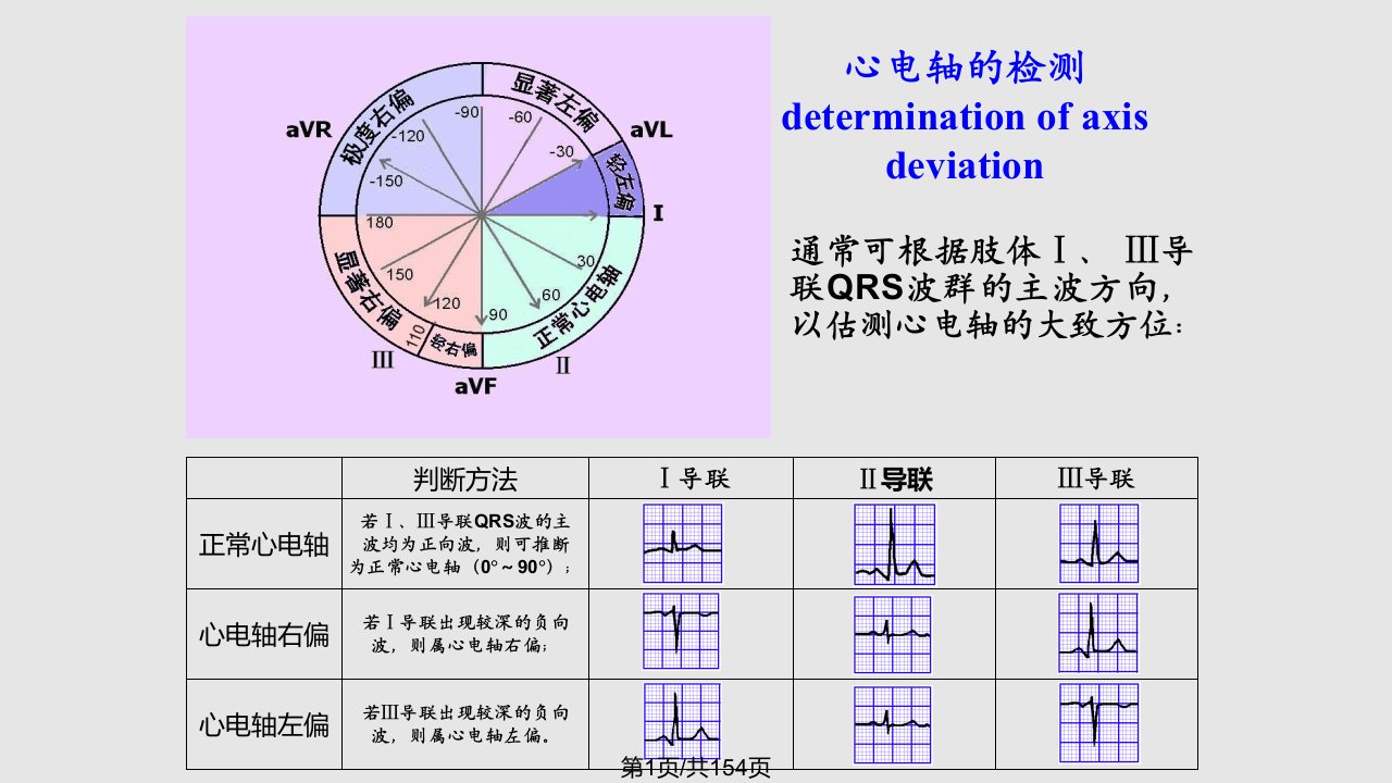 详细的心电图讲解PPT课件