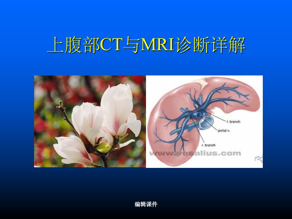 上腹部ct与mri诊断详解