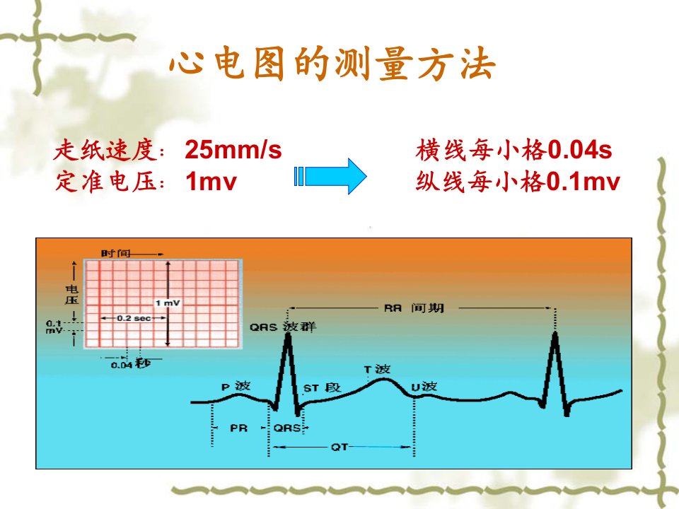 正常心电图及常见异常心电图ppt课件