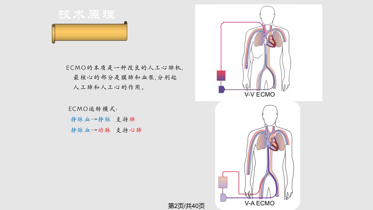 ECMO治疗危重患者进展