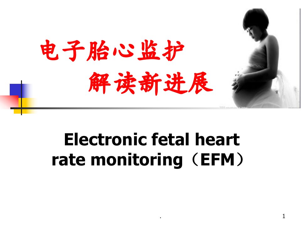 电子胎心监护解读新进展精选幻灯片