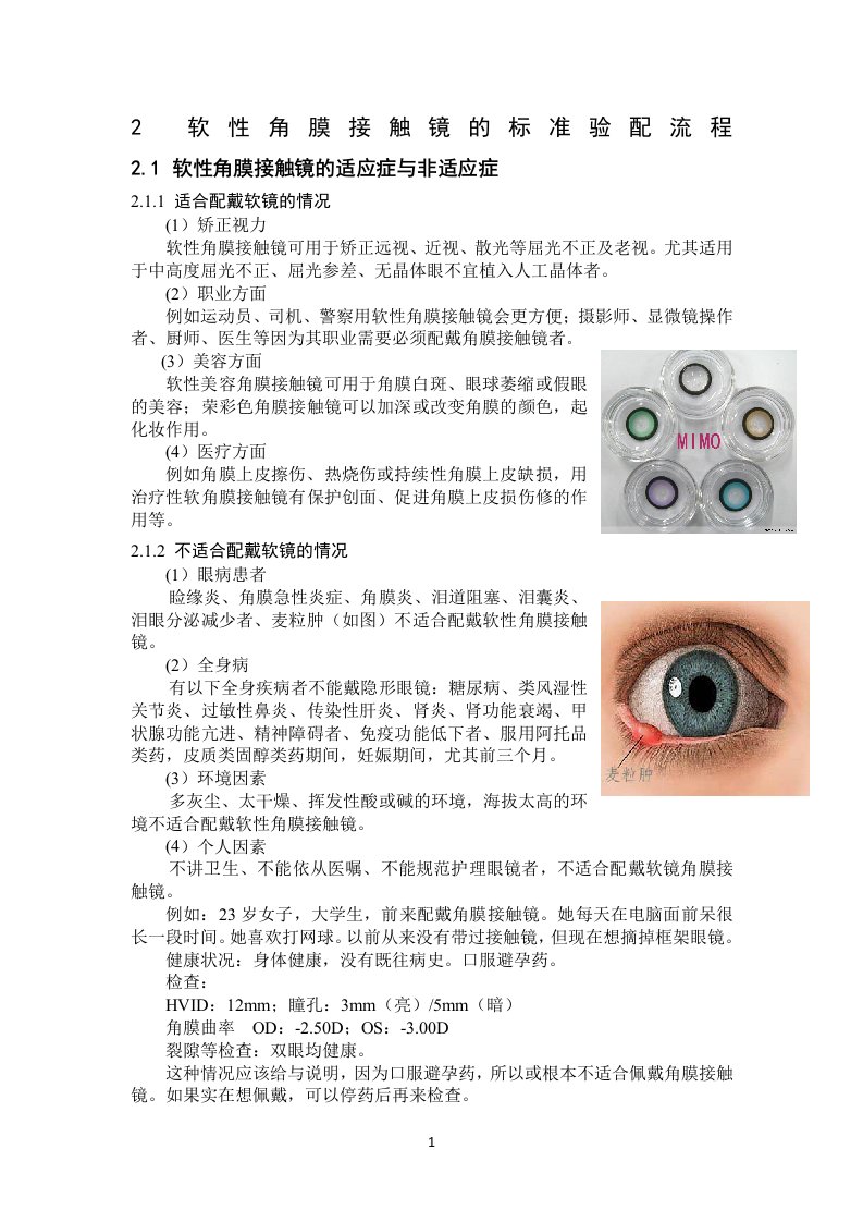 软性角膜接触镜的标准验配流程