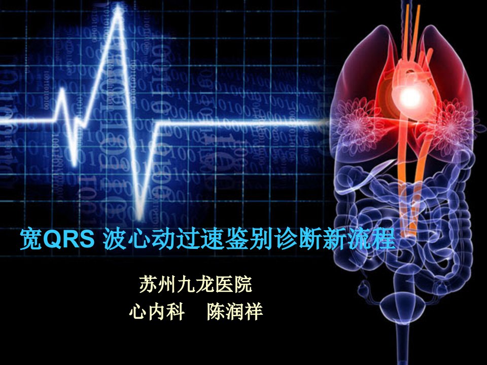 宽QRS波心动过速鉴别诊断新流程