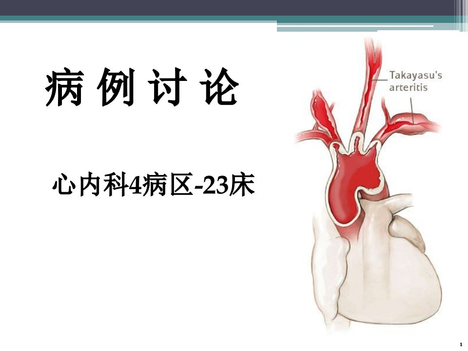 病例讨论5b23床