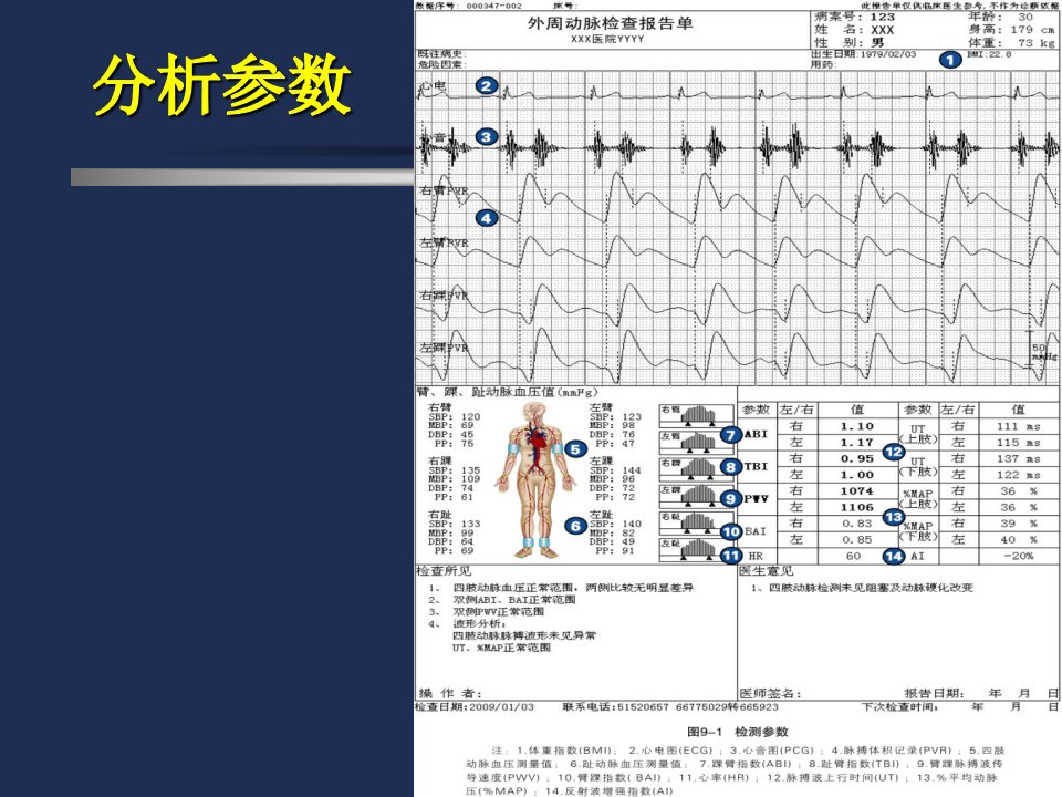 外周动脉检测分析技术