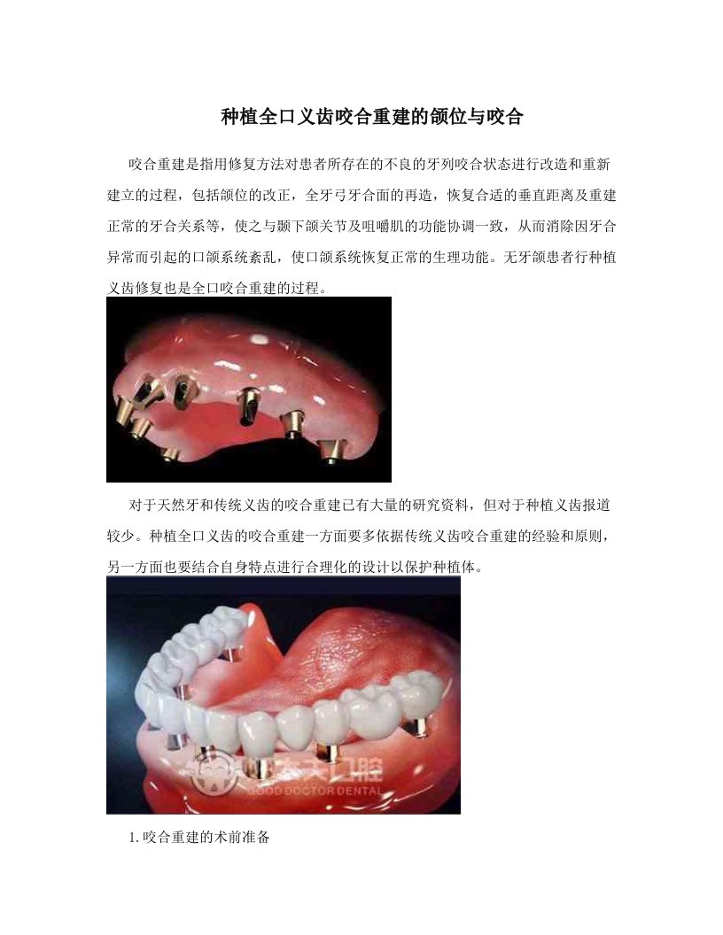 种植全口义齿咬合重建的颌位与咬合