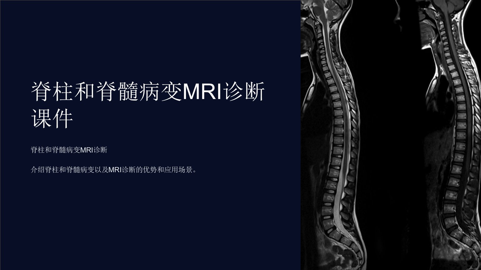 脊柱和脊髓病变mri诊断课件