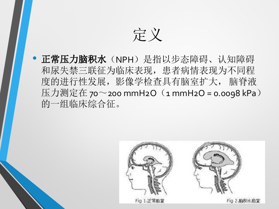 医学专题中国特发性正常压力脑积水诊治专家共识