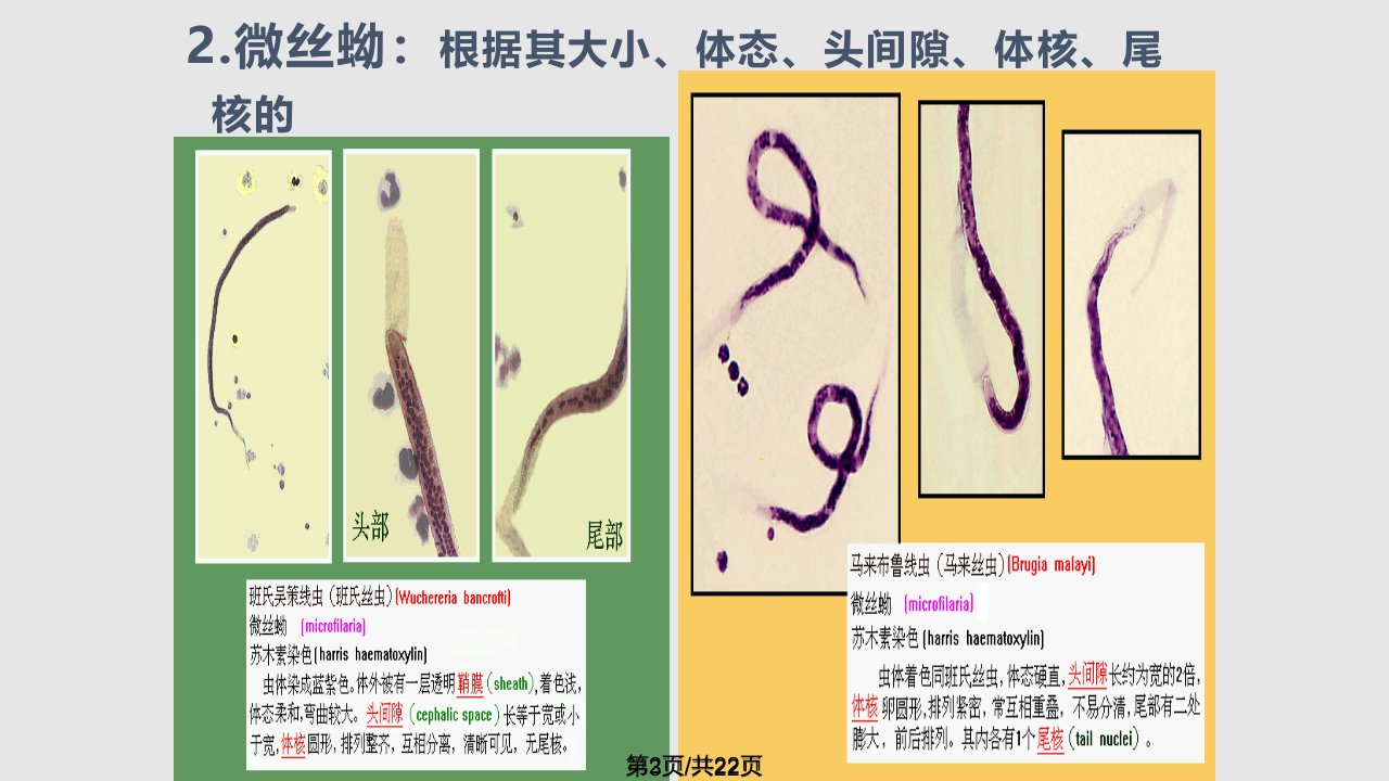 班氏吴策线虫和马来布鲁线虫