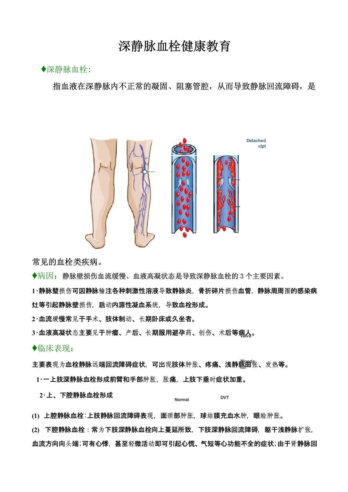 深静脉血栓健康教育