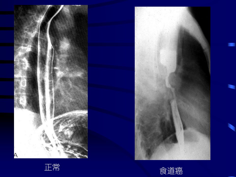 《消化系统带教》PPT课件