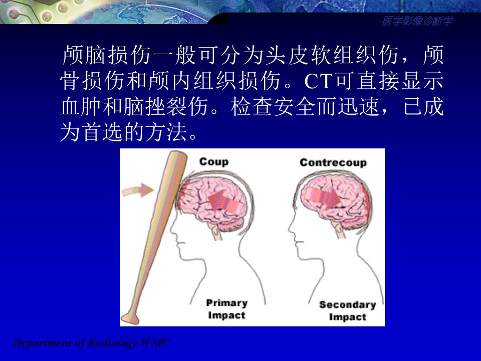 医学影像诊断学颅脑篇ppt课件