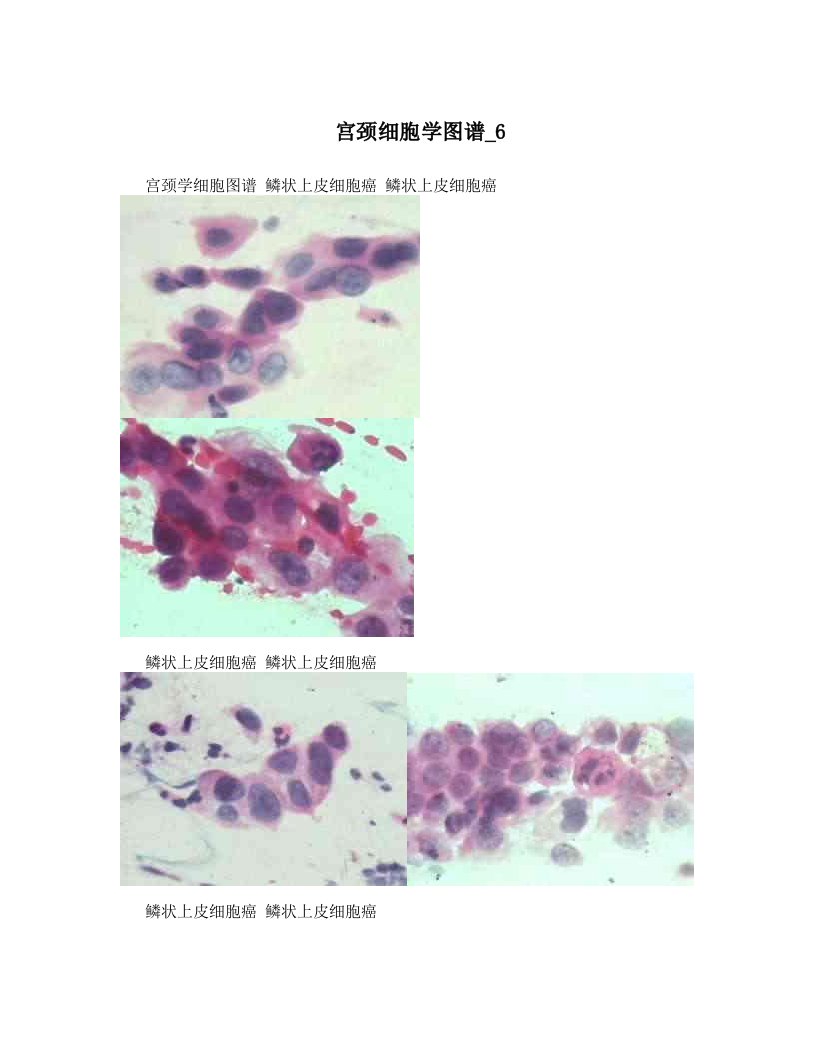 宫颈细胞学图谱_6