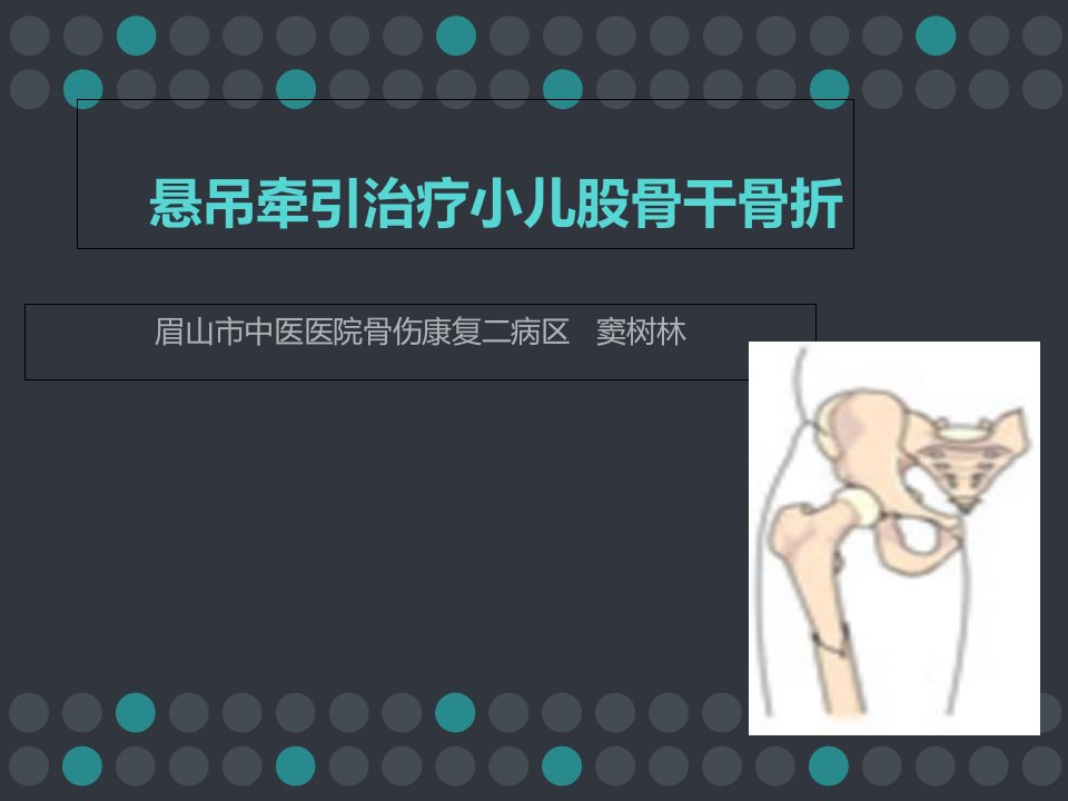 悬吊牵引治疗小儿股骨干骨折ppt课件