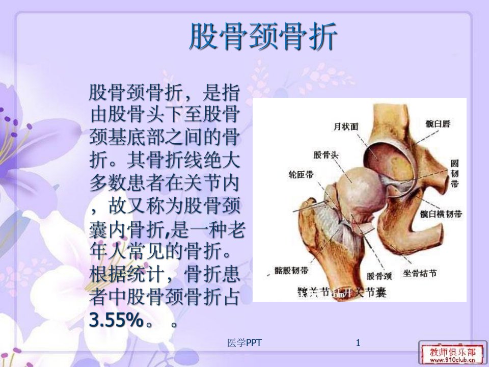 《股骨颈骨折》PPT课件