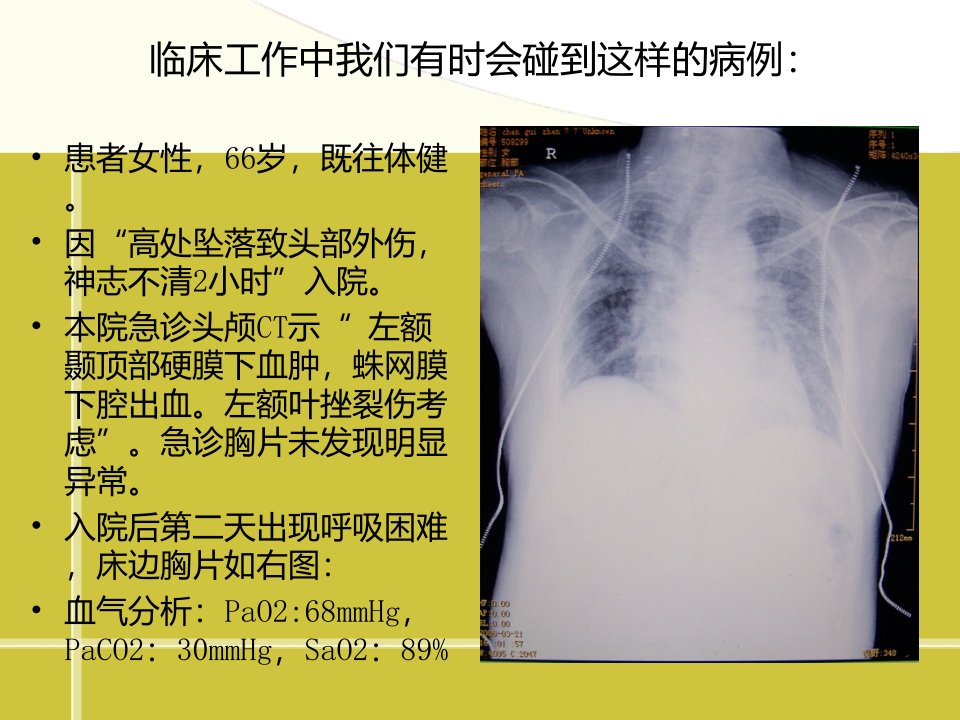 医学专题顽固性低氧血症的诊治