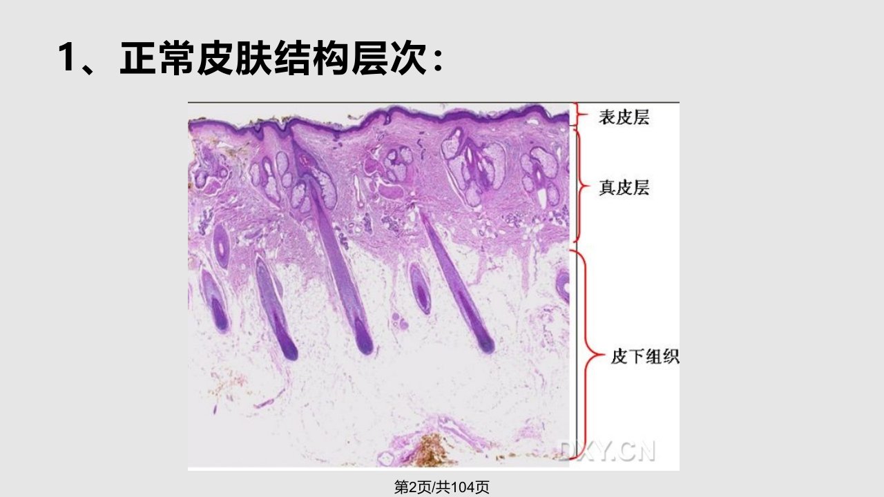 肿瘤诊治技术皮肤肿瘤