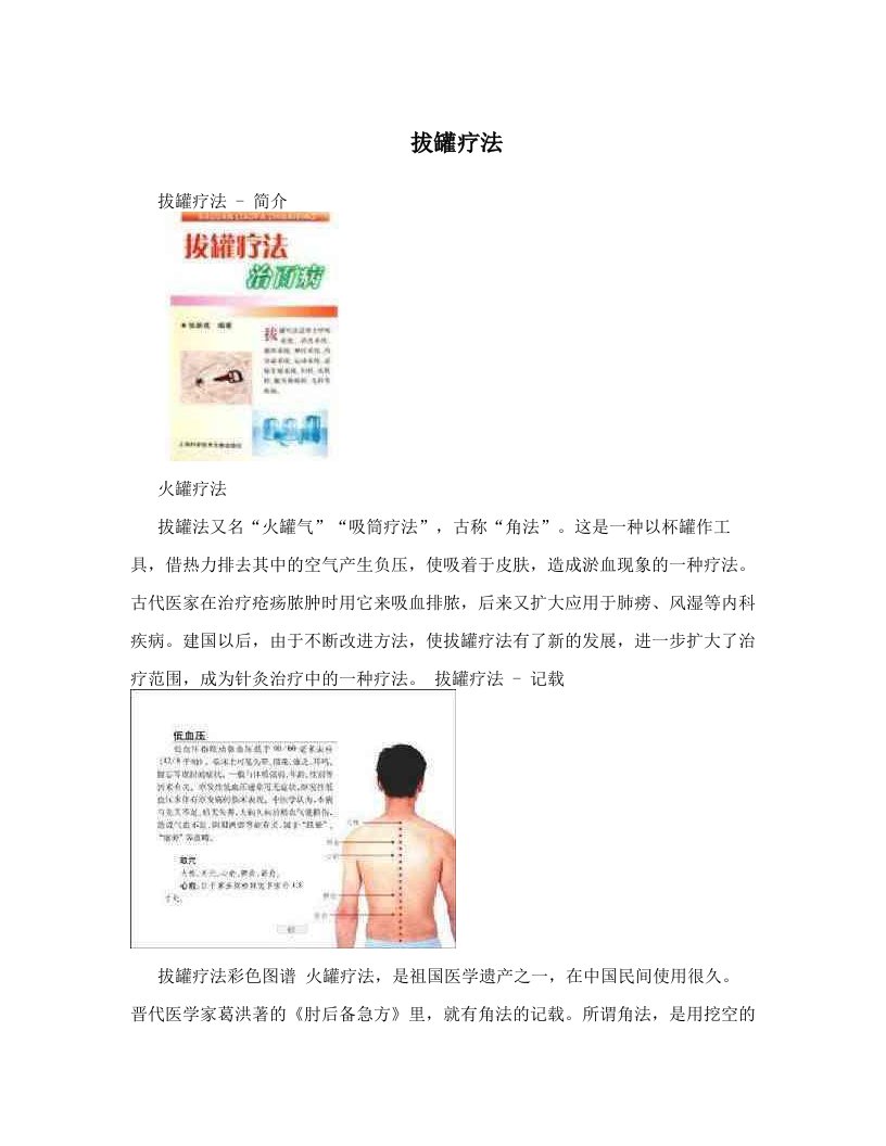 拔罐疗法