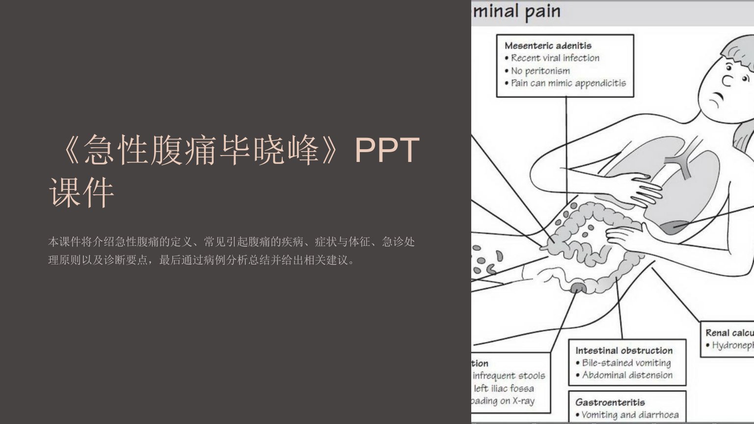 《急性腹痛毕晓峰》课件