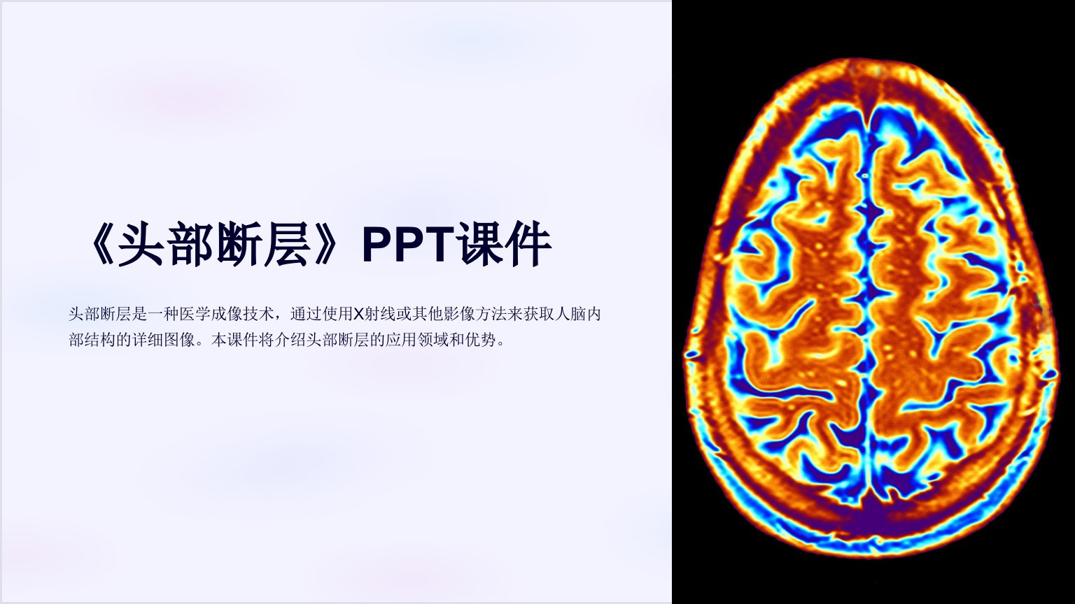 《头部断层》课件