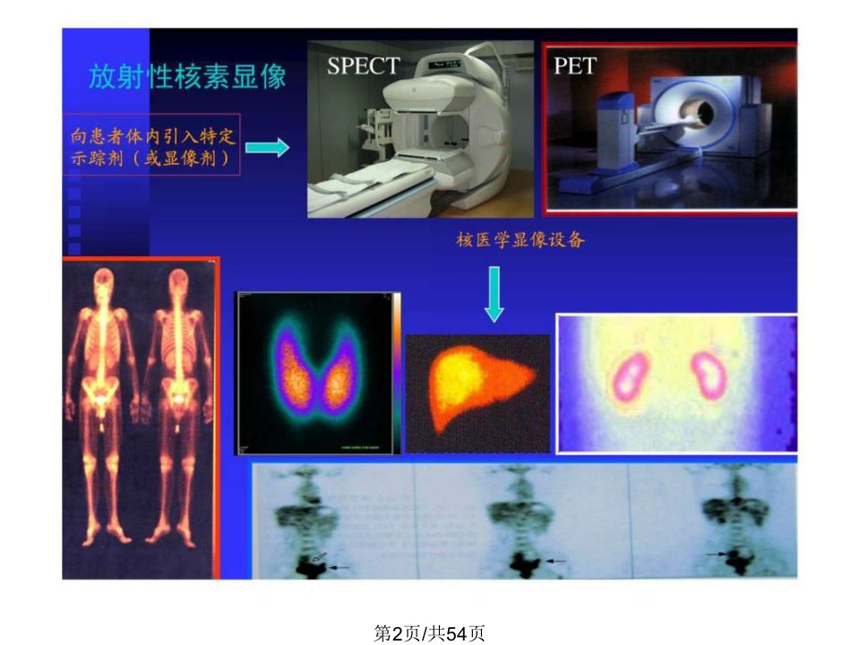 核医学显像原理